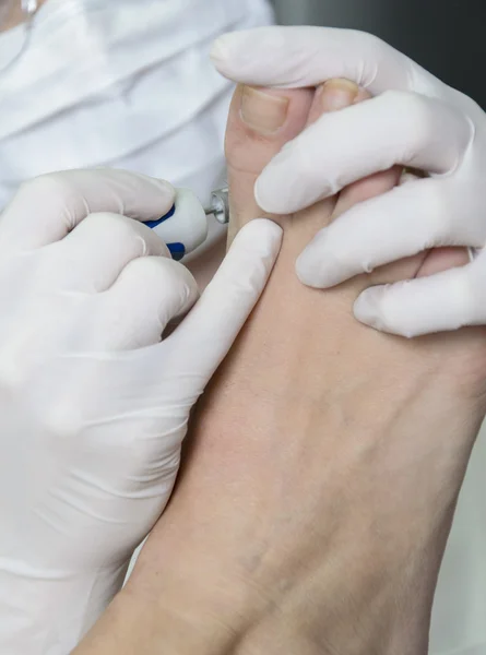 Tratamento da pedicura — Fotografia de Stock