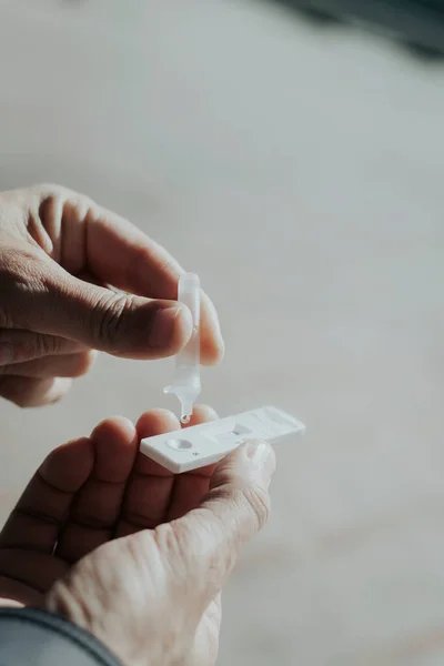 Primer Plano Joven Colocando Propia Muestra Una Pipeta Dispositivo Prueba — Foto de Stock