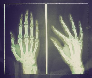 Retro görünüm xray