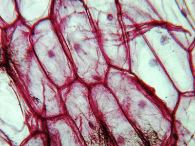 soğan epidermus test