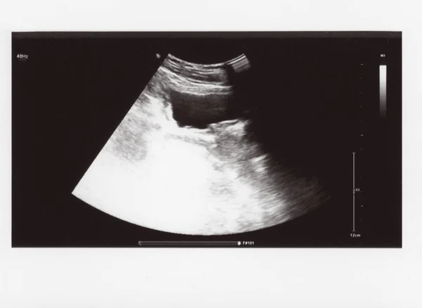 full abdomen ultrasound image aka diagnostic sonogram