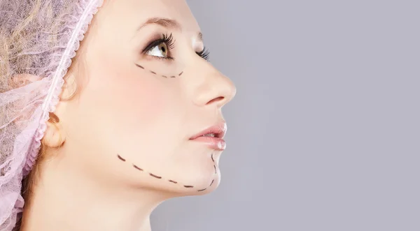 Iniezione cosmetica di botox, nel viso femminile — Foto Stock