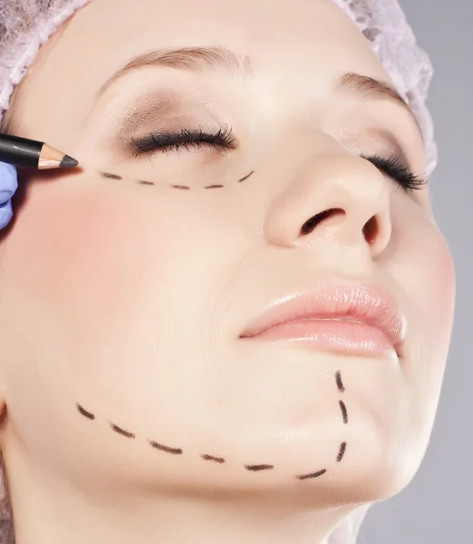 Injeção cosmética de botox no rosto feminino. — Fotografia de Stock