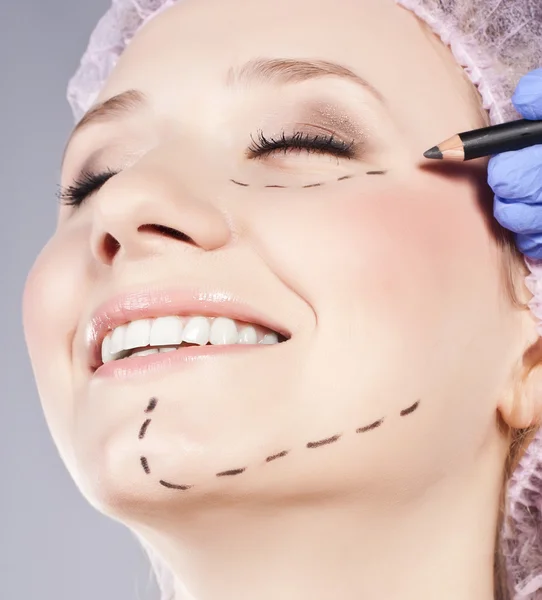 Kosmetiska botox injektion, i den kvinnliga ansiktet — Stockfoto