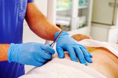 Cerrah ve asistan ameliyat yaparken doktor elini kapat. Ameliyathanede çeşitli cerrahi aletler kullanan tıbbi ekip..