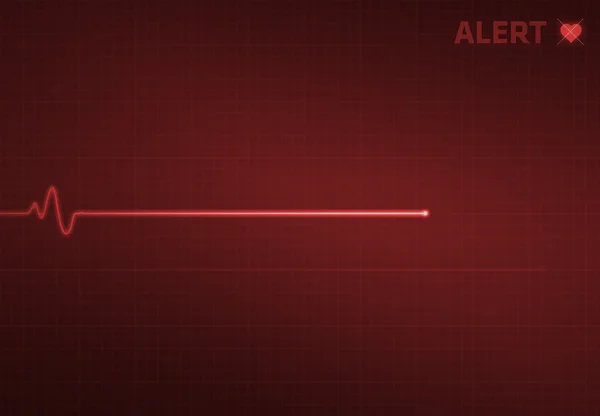 Flatline Heart Monitor - Alert Stockbild