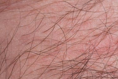 İnsan derisi üzerinde uzun saçlar, saçları yakın ten.