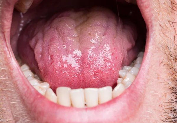 Hombre Abre Boca Muestra Lengua — Foto de Stock