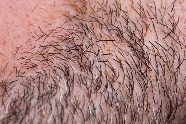 Мужские Усы Рыжая Борода Макро — стоковое фото