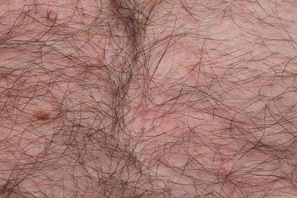 Длинные Волосы Коже Человека Кожа Волосами — стоковое фото