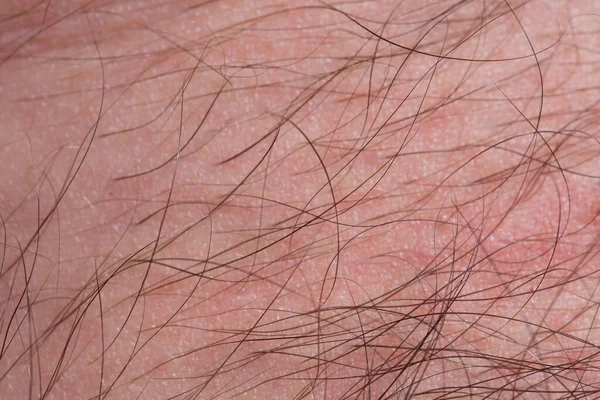 Long Hair Human Skin Skin Hair Close Stock Photo