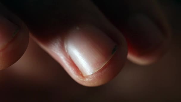 Finger Eines Schmutzigen Nagelmännchens Bewegen Sich Sehr Nah — Stockvideo