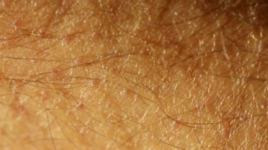 Uzun saçlı birinin derisi büzülür ve çok yakınlaşır.