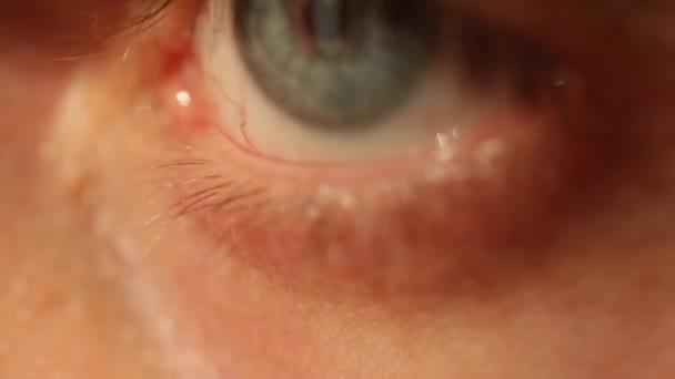 Tired Male Gray Eye Red Capillaries Eyelashes Close — Stock Video
