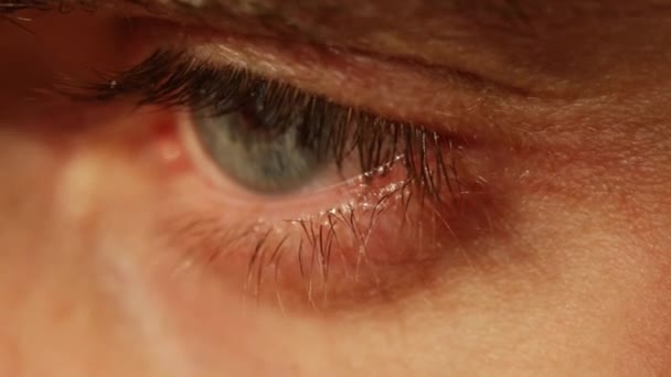 Oeil Masculin Fatigué Couleur Grise Avec Capillaires Rouges Cils Gros — Video