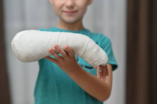 Ένα αγόρι με σπασμένο χέρι σε γύψο. κοντινό πλάνο. — Φωτογραφία Αρχείου