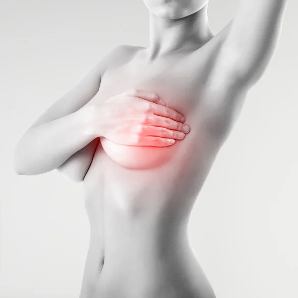 Vrouw behandeling van borst mastopathy of kanker — Stockfoto