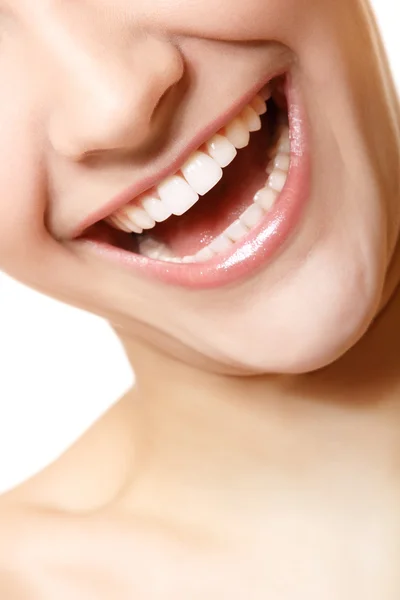 Sourire parfait de belle femme avec de grandes dents blanches en bonne santé . — Photo