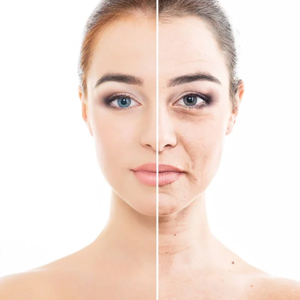 Tratamento Envelhecimento Beleza Retrato Mulher Bonita Com Problema Antigo Pele — Fotografia de Stock