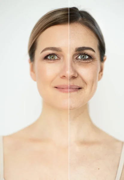 Tratamento Envelhecimento Beleza Retrato Bela Mulher Anos Com Pele Limpa — Fotografia de Stock