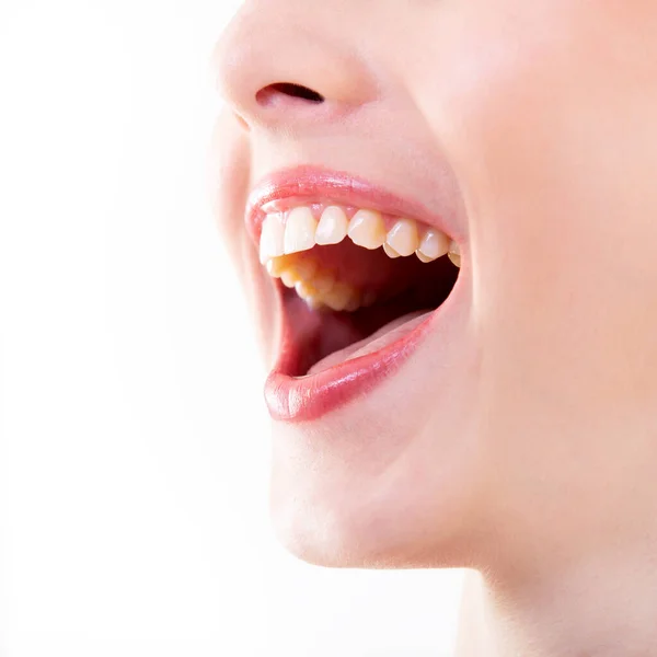 笑一个健康而美丽 笑着的女人 有着巨大的牙齿的女人的嘴覆盖着白色的背景 牙齿健康 假肢和护理 快乐与喜悦 — 图库照片
