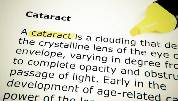 Cataract — Stock Photo, Image