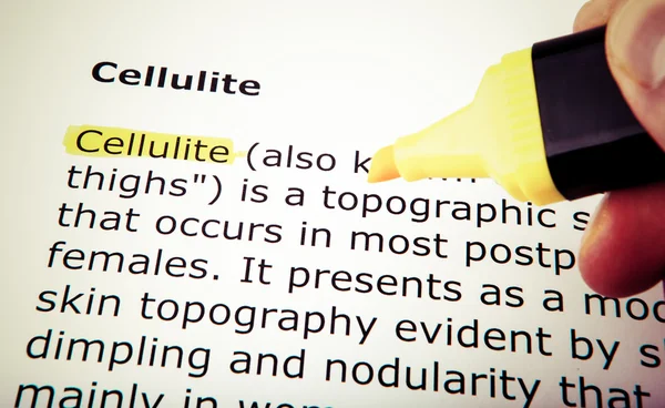 Cellulite — Photo