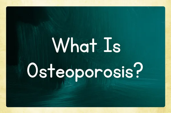 Що таке остеопорозу ? — стокове фото