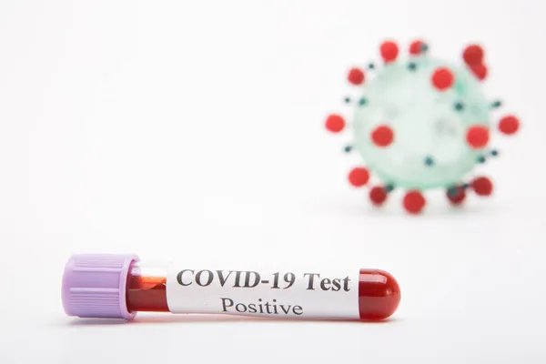 Тестова трубка з позитивним тестом COVID-19 на білому тлі — стокове фото