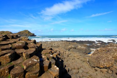 Causeway, Kuzey İrlanda dev