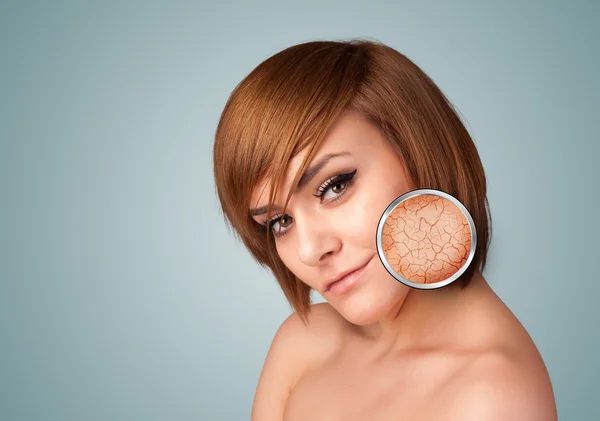 Beautiful young girl with magnifying glass of skin damage — Stock Photo, Image