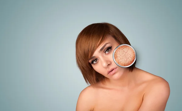 Beautiful young girl with magnifying glass of skin damage — Stock Photo, Image