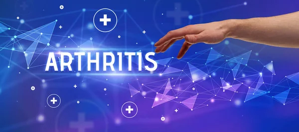 Arthritis Feliratra Mutató Levágott Kéz Közelképe Orvosi Fogalom — Stock Fotó