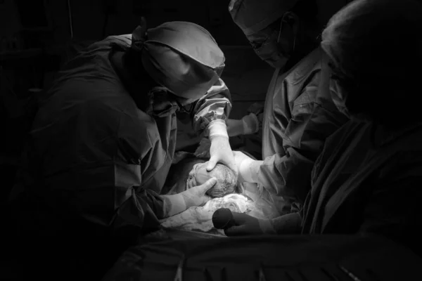 Cesarean Section Operation Process Child Closeup — Foto de Stock