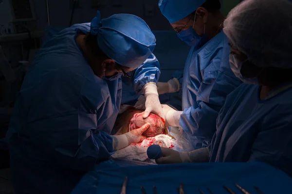 Cesariana Operação Está Andamento Criança Closeup — Fotografia de Stock