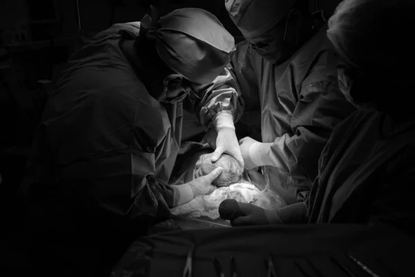 Bagian Cesarean Operasi Sedang Berlangsung Anak Itu Menutup Diri — Stok Foto