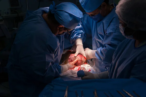 Taglio Cesareo Operazione Corso Primo Piano Del Bambino — Foto Stock