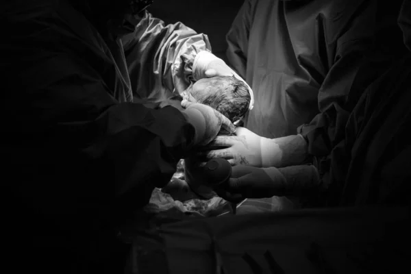 Cesarean Section Operation Process Child Closeup — Foto de Stock