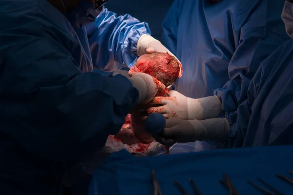 Cesarean Section Operation Process Child Closeup — Fotografia de Stock