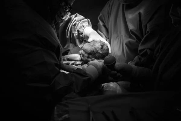 Cesariana Operação Está Andamento Criança Closeup — Fotografia de Stock