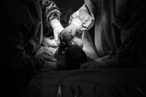 Cesarean Section Operation Process Child Closeup — Stock Photo, Image