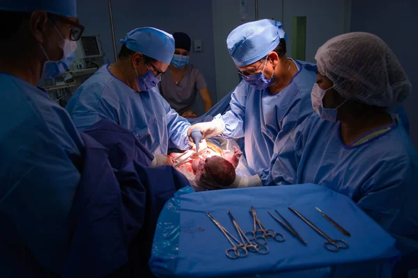Cesarean Section Operation Process Child Closeup Stok Gambar
