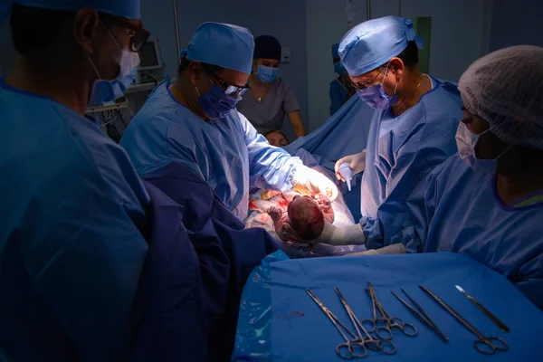 Kaiserschnitt Die Operation Ist Gange Die Nahaufnahme Des Kindes — Stockfoto
