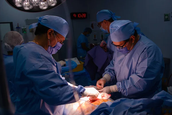 Cesarean Section Operation Process Child Closeup — Foto de Stock