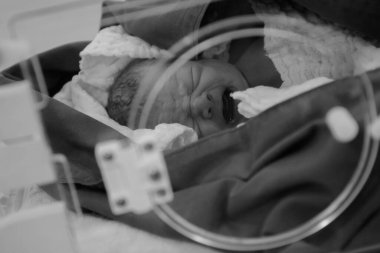 Newborn in the first few minutes of life in a hospital room.