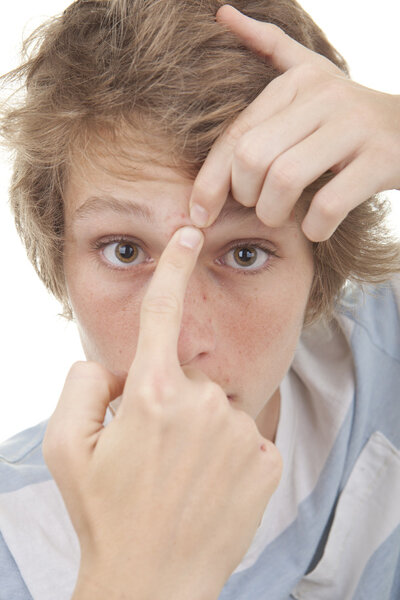 teen squeezing acne spot