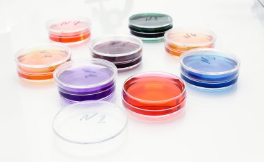 eski plastik petri yemeklerinde renkli sıvı