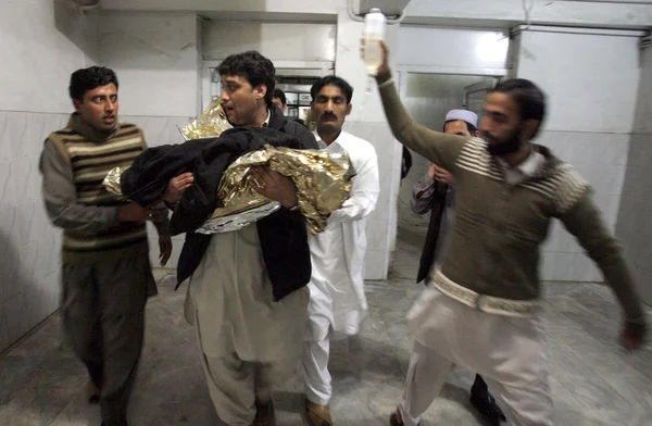 Injured child, who injured in bus accident that fall into canal at Charsadda road — Stock Photo, Image