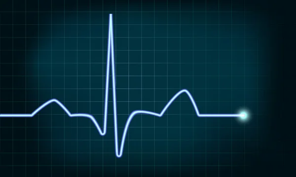 Curva do batimento cardíaco — Vetor de Stock
