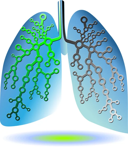 Diagnósticos pulmonares — Vector de stock